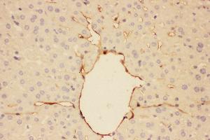 Immunohistochemistry (IHC) image for anti-Adiponectin (ADIPOQ) (AA 19-244) antibody (ABIN3042521)