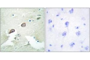 Immunohistochemistry analysis of paraffin-embedded human brain tissue, using HER3 (Ab-1222) Antibody. (ERBB3 抗体  (AA 1191-1240))