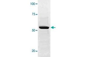 The whole cell lysate derived from conditioned LNCaP were immunoblotted SOX9 (phospho S181) polyclonal antibody  at 1 : 500. (SOX9 抗体  (pSer181))