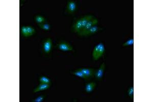 Immunofluorescent analysis of Hela cells using ABIN7161979 at dilution of 1:100 and Alexa Fluor 488-congugated AffiniPure Goat Anti-Rabbit IgG(H+L) (NOP58 抗体  (AA 1-529))
