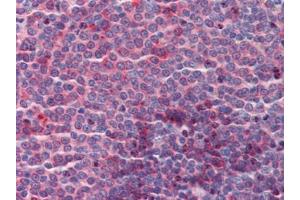 Immunohistochemistry (Paraffin-embedded Sections) (IHC (p)) image for anti-CUE Domain Containing 2 (CUEDC2) (C-Term) antibody (ABIN615370)
