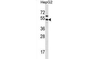 Western Blotting (WB) image for anti-Grainyhead-Like 1 (GRHL1) antibody (ABIN2998692) (GRHL1 抗体)