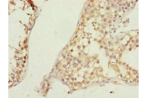 Immunohistochemistry of paraffin-embedded human testis tissue using ABIN7147449 at dilution of 1:100 (CSPP1 抗体  (AA 997-1256))