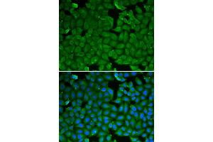 Immunofluorescence analysis of HeLa cell using SPINK1 antibody. (SPINK1 抗体)