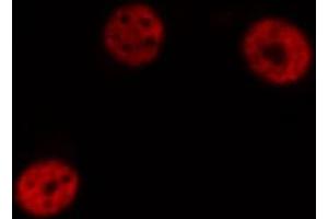 ABIN6274297 staining HeLa cells by IF/ICC. (DLX5 抗体  (Internal Region))