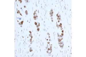Immunohistochemistry (IHC) image for anti-Proliferating Cell Nuclear Antigen (PCNA) (AA 225-261) antibody (ABIN7449543)