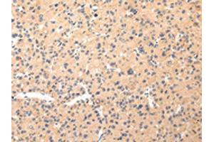 Immunohistochemistry (IHC) image for anti-Collagen, Type VIII, alpha 2 (COL8A2) antibody (ABIN7190330)