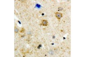 Immunohistochemical analysis of GRK3 staining in human brain formalin fixed paraffin embedded tissue section. (ADRBK2 抗体)