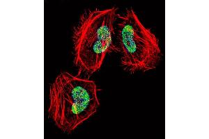 Fluorescent confocal image of Hela cell stained with HDAC4 Antibody (C-term) (ABIN657638 and ABIN2846634). (HDAC4 抗体  (C-Term))