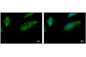 ICC/IF Image CoCoA antibody [N2C2], Internal detects CALCOCO1 protein at cytoplasm by immunofluorescent analysis. (CALCOCO1 抗体)