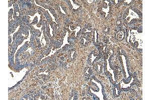 Immunohistochemistry (IHC) image for anti-Vacuolar Protein Sorting 35 (VPS35) (C-Term) antibody (ABIN185182)