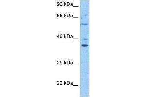 Host:  Rabbit  Target Name:  TMEM173  Sample Tissue:  Human 786-0 Whole Cell  Antibody Dilution:  1ug/ml (STING/TMEM173 抗体  (Middle Region))