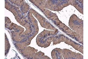IHC-P Image FAK antibody detects FAK protein at cytoplasm in rat prostate by immunohistochemical analysis. (FAK 抗体  (C-Term))