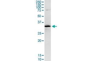 CENPH MaxPab rabbit polyclonal antibody. (CENPH 抗体  (AA 1-247))