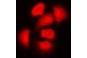 Immunofluorescent analysis of ASC-1 staining in Hela cells. (TRIP4 抗体)