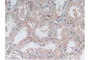 IHC-P analysis of Human Kidney Tissue, with DAB staining. (P-Selectin 抗体  (AA 198-432))