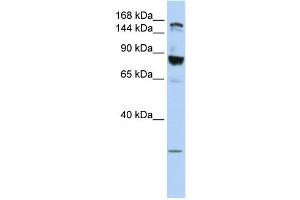 WB Suggested Anti-TJP2 Antibody Titration:  0. (TJP2 抗体  (Middle Region))
