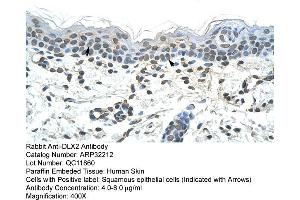 Human Skin (DLX2 抗体  (C-Term))