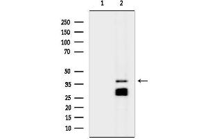 Western blot analysis of lysates from MCF7 cells(serum starvation treatment), using STEAP1 Antibody.