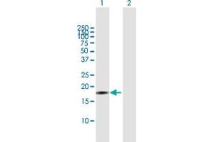 Western Blotting (WB) image for anti-Inhibitor of DNA Binding 4, Dominant Negative Helix-Loop-Helix Protein (ID4) (AA 1-161) antibody (ABIN516801)