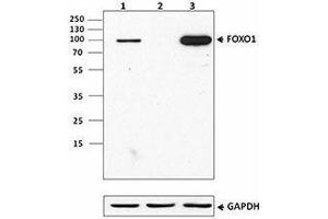 Western Blotting (WB) image for anti-Forkhead Box O1 (FOXO1) antibody (ABIN2664978) (FOXO1 抗体)