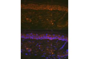 Immunofluorescence analysis of Mouse tail and ear using Cytokeratin 16 (KRT16) Rabbit mAb (ABIN7268094) at dilution of 1:100 (40x lens). (KRT16 抗体)