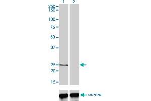 Western blot analysis of PCTP over-expressed 293 cell line, cotransfected with PCTP Validated Chimera RNAi (Lane 2) or non-transfected control (Lane 1). (PCTP 抗体  (AA 1-214))