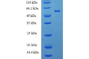 SDS-PAGE (SDS) image for Protein tyrosine Phosphatase, Receptor Type, R (PTPRR) (AA 1-412), (full length) protein (His-SUMO Tag) (ABIN5711341) (PTPRR Protein (AA 1-412, full length) (His-SUMO Tag))