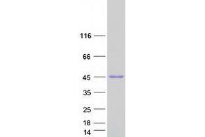 Western Blotting (WB) image for Kinetochore-associated protein DSN1 homolog (DSN1) (Transcript Variant 1) protein (Myc-DYKDDDDK Tag) (ABIN2719771)