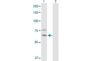 Western Blot analysis of IL2RB expression in transfected 293T cell line by IL2RB MaxPab polyclonal antibody. (IL2 Receptor beta 抗体  (AA 1-551))