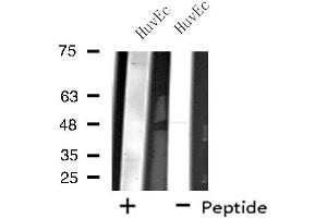 Western blot analysis of extracts from HuvEc cells, using ZNF446 antibody. (ZNF446 抗体  (Internal Region))