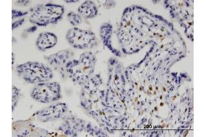 Immunoperoxidase of monoclonal antibody to IRF5 on formalin-fixed paraffin-embedded human placenta. (IRF5 抗体  (AA 1-498))