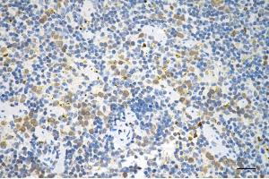 Immunohistochemistry was performed on paraffin-embedded mouse spleen using P70 S6 kinase beta antibody (ABIN7800226), 1:200). (Recombinant RPS6KB2 抗体)