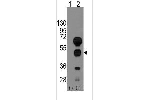 Western blot analysis of GATA4 (arrow) using rabbit polyclonal GATA4 Antibody (C-term) (ABIN388153 and ABIN2846917). (GATA4 抗体  (C-Term))