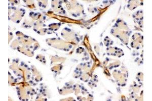 IHC analysis of DARPP32 using anti-DARPP32 antibody (ABIN3044534).