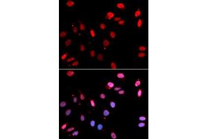 Immunofluorescence analysis of GFP-RNF168 trangenic U2OS cell using RAD18 antibody. (RAD18 抗体)