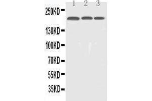 Anti-EGFR Picoband antibody,  All lanes: Anti-EGFR at 0. (EGFR 抗体  (AA 25-346))