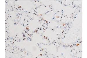 ABIN6267602 at 1/200 staining Rat lung tissue sections by IHC-P. (NF-kB p65 抗体  (pSer281))