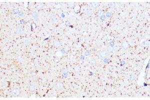 Immunohistochemistry of paraffin-embedded Rat brain using MAOA Polyclonal Antibody at dilution of 1:100 (40x lens). (Monoamine Oxidase A 抗体)
