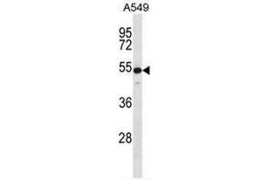 KRT7 Antibody (N-term) western blot analysis in A549 cell line lysates (35µg/lane). (Cytokeratin 7 抗体  (N-Term))