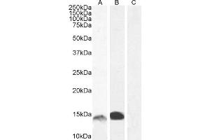 Western Blotting (WB) image for anti-S100 Calcium Binding Protein A9 (S100A9) (Internal Region) antibody (ABIN335161)