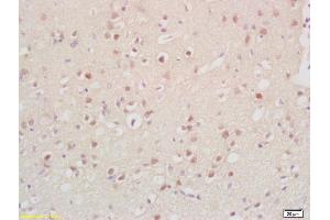 Formalin-fixed and paraffin embedded rat brain labeled with Anti-Cyclin G2 Polyclonal Antibody, Unconjugated (ABIN704621) at 1:200, followed by conjugation to the secondary antibody and DAB staining