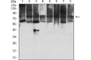 Western Blotting (WB) image for anti-MYST Histone Acetyltransferase 2 (MYST2) (AA 1-200) antibody (ABIN7193385)