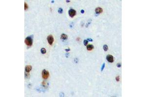 Immunohistochemical analysis of LYL1 staining in human brain formalin fixed paraffin embedded tissue section. (LYL1 抗体  (Center))