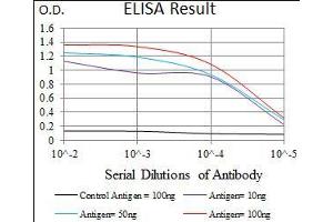 Black line: Control Antigen (100 ng), Purple line: Antigen(10 ng), Blue line: Antigen (50 ng), Red line: Antigen (100 ng), (CBX8 抗体  (AA 17-222))