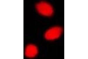 Immunofluorescent analysis of CBX4 staining in A549 cells. (CBX4 抗体)