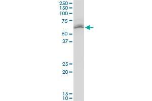 STK4 polyclonal antibody (A01), Lot # 060707JCS1. (STK4 抗体  (AA 391-485))