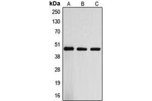 Western blot analysis of ARRDC3 expression in Jurkat (A), mouse liver (B), rat liver (C) whole cell lysates. (ARRDC3 抗体  (C-Term))