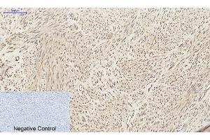 Immunohistochemical analysis of paraffin-embedded human uterus tissue. (CXCL12 抗体  (C-Term))