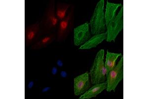 ABIN6259230 and ABIN6274702 staining  cells by IF/ICC. (RAD54L 抗体  (C-Term))